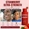 Advanced Triple Acid Complex For Hyperpigmentation