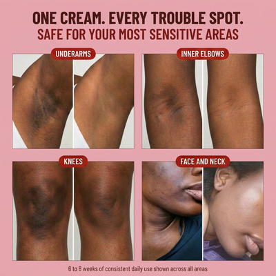 Advanced Triple Acid Complex For Hyperpigmentation